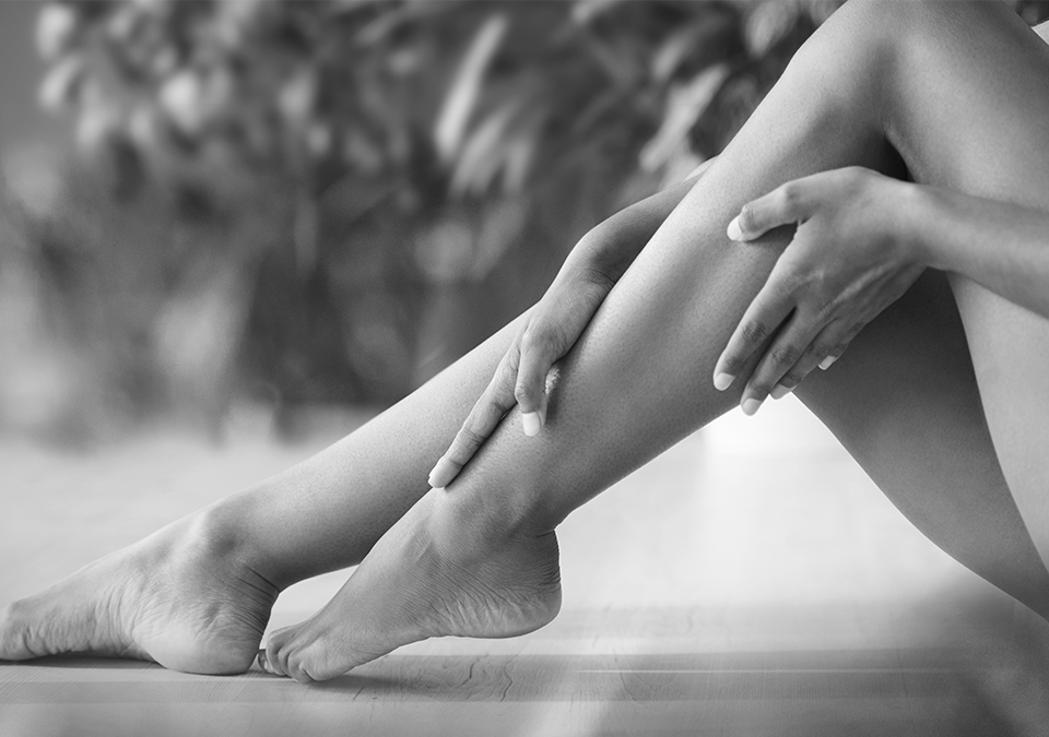 Clinique_K_Blogue_Entete_Varices